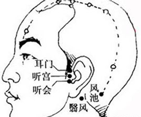 耳門(mén)穴→開(kāi)竅聰耳