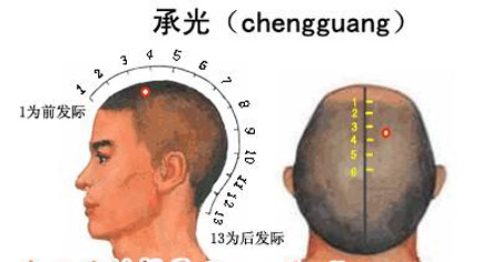 承光穴→治頭痛、鼻炎