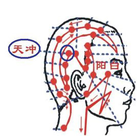 天沖穴→治頭痛、齒痛