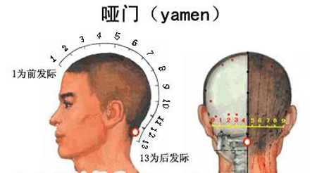 啞門(mén)穴→治音啞、頭痛