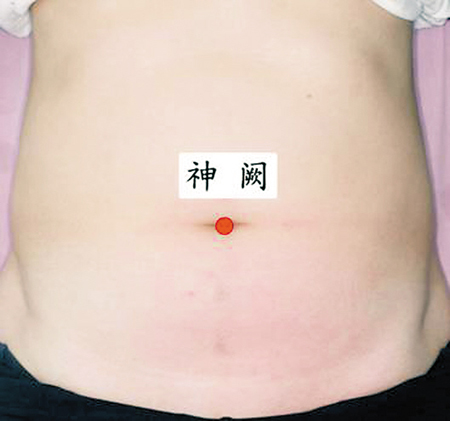 神闕穴→治腸炎、痢疾
