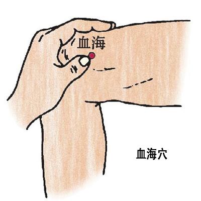 血海穴→治濕疹、丹毒