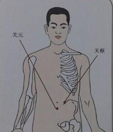 針灸治療便秘哪個穴位？便秘的針灸療法