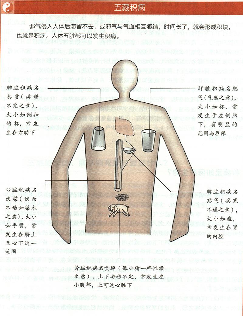 積病是如何產(chǎn)生的？